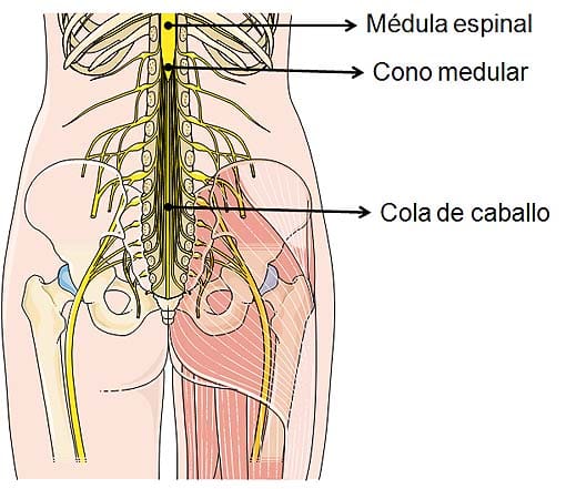 sindrome de la cola de caballo